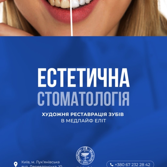 Естетична стоматологія. Художня реставрація зубів у «МедЛайф Еліт»